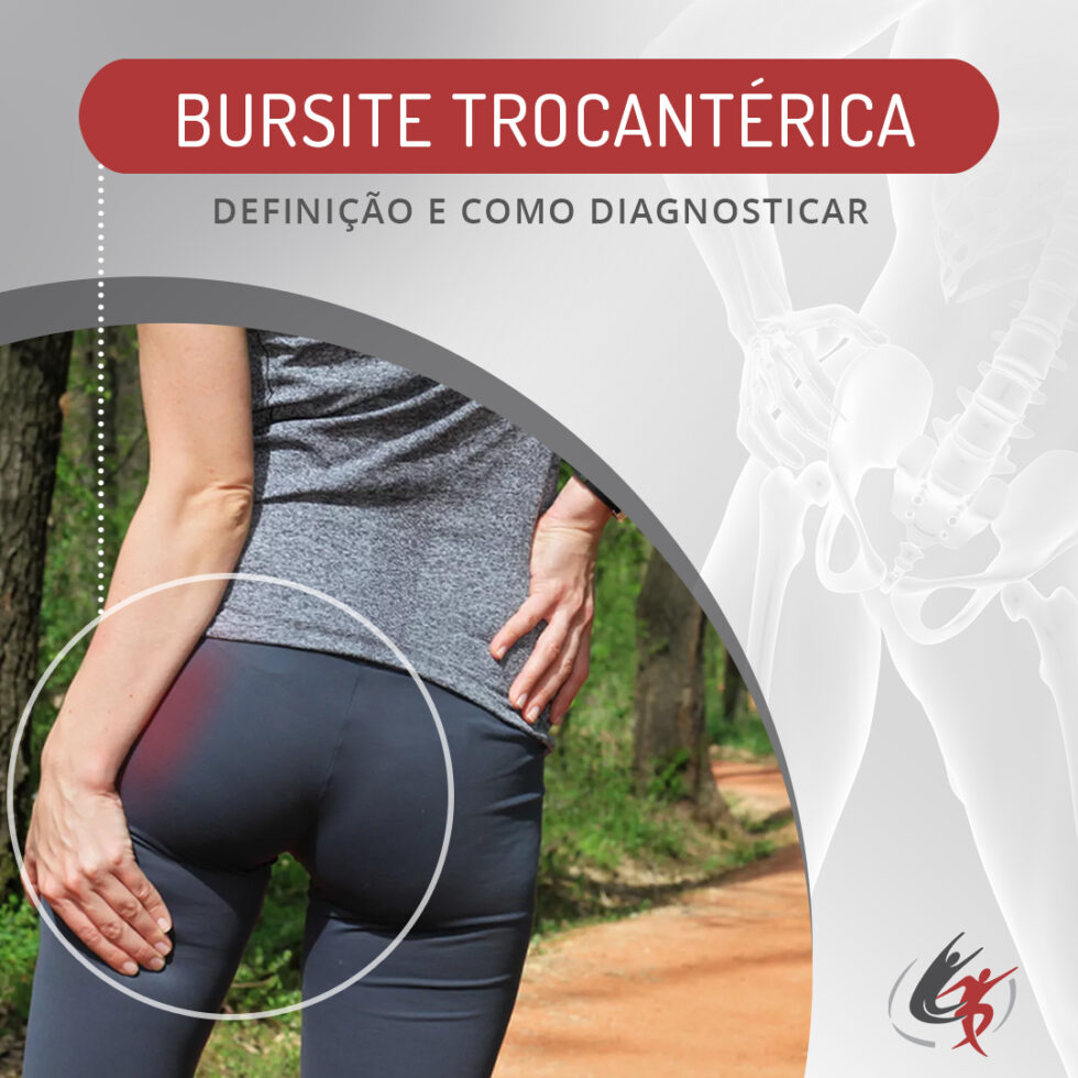 Bursite Trocantérica OrtoPro Curitiba