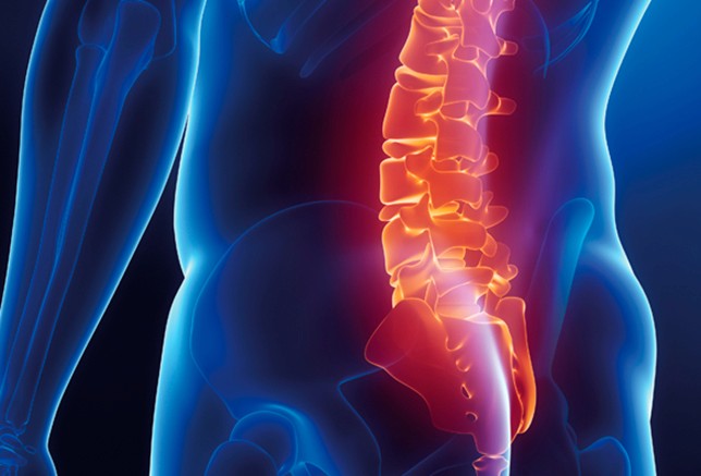 ALIF: a cirurgia minimamente invasiva da coluna lombar realizada pela via anterior
